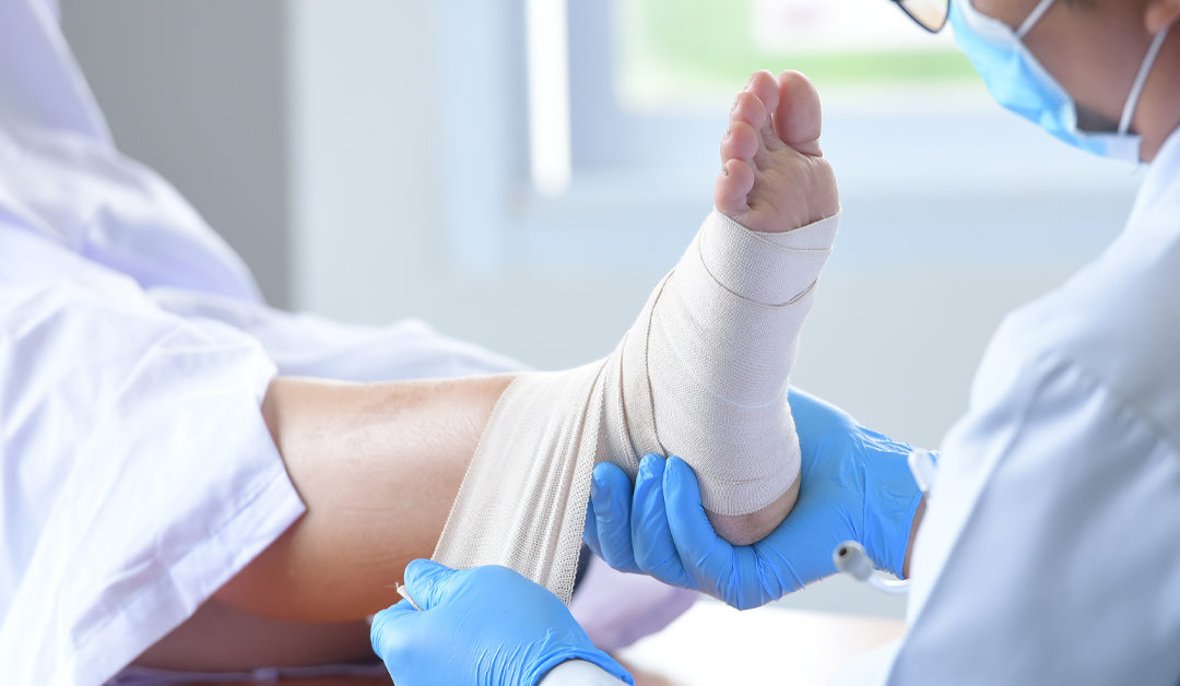 Wound Debridement for Diabetes