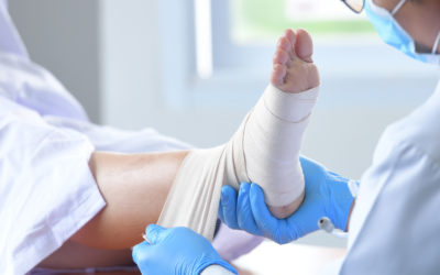 Wound Debridement for Diabetes